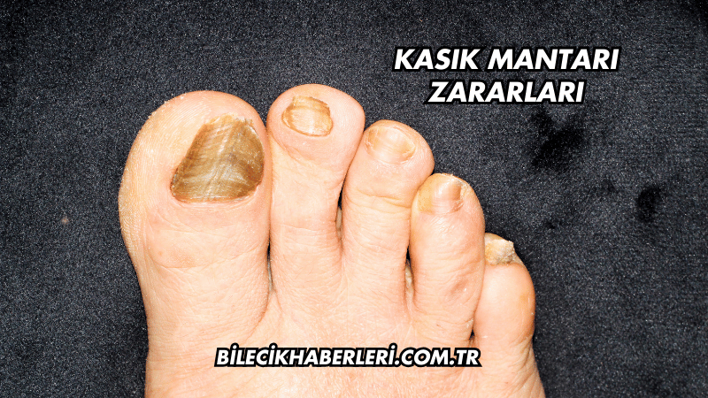 Kasık Mantarı Zararları