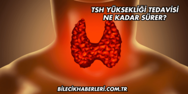 TSH Yüksekliği Tedavisi Ne Kadar Sürer?