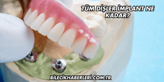 Tüm Dişler İmplant Ne Kadar?