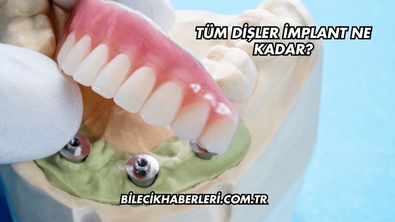 Tüm Dişler İmplant Ne Kadar?