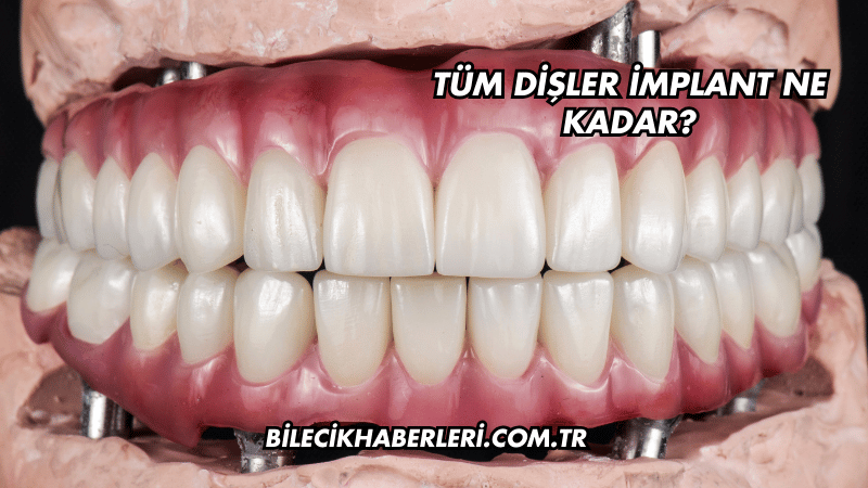 Tüm Dişler İmplant Ne Kadar?