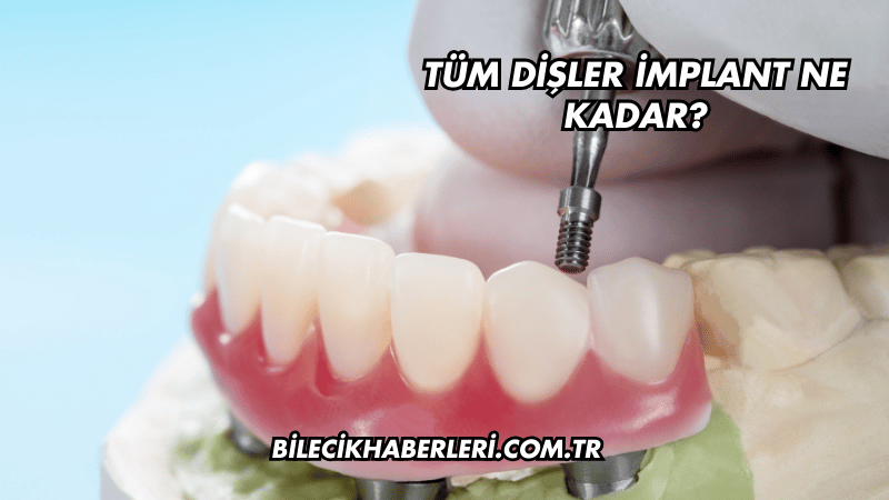 Tüm Dişler İmplant Ne Kadar?