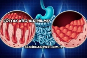 Çölyak Kilo Aldırır mı?