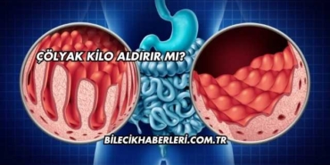 Çölyak Kilo Aldırır mı?